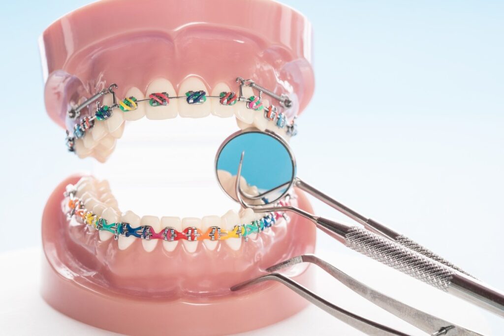 Dental implants clinic in Egmore